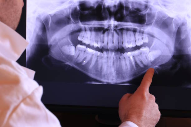 Best Emergency Tooth Extraction in Ganado, TX
